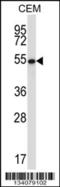 GA Binding Protein Transcription Factor Subunit Alpha antibody, 57-435, ProSci, Western Blot image 