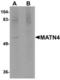 Matrilin 4 antibody, TA306756, Origene, Western Blot image 