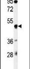 Gasdermin A antibody, PA5-24813, Invitrogen Antibodies, Western Blot image 