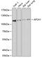 Adaptor Related Protein Complex 2 Subunit Alpha 1 antibody, 22-512, ProSci, Western Blot image 