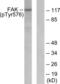 Protein Tyrosine Kinase 2 antibody, LS-C198952, Lifespan Biosciences, Western Blot image 