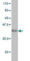 Pseudopodium Enriched Atypical Kinase 1 antibody, MBS645902, MyBioSource, Western Blot image 