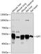 Glutamic--Pyruvic Transaminase antibody, GTX64602, GeneTex, Western Blot image 
