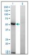 N-Acylsphingosine Amidohydrolase 1 antibody, AM31723PU-N, Origene, Western Blot image 