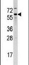 Cell Division Cycle 25B antibody, PA5-14101, Invitrogen Antibodies, Western Blot image 