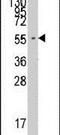 Phenylalanyl-TRNA Synthetase Subunit Alpha antibody, PA5-14508, Invitrogen Antibodies, Western Blot image 