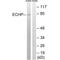 Enoyl-CoA Hydratase And 3-Hydroxyacyl CoA Dehydrogenase antibody, A05757, Boster Biological Technology, Western Blot image 