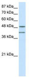 Ribonucleic Acid Export 1 antibody, TA345742, Origene, Western Blot image 