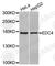 Enhancer Of MRNA Decapping 4 antibody, A3399, ABclonal Technology, Western Blot image 