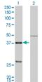 Cathepsin K antibody, H00001513-M01, Novus Biologicals, Western Blot image 