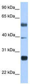 MAX Dimerization Protein 3 antibody, TA345425, Origene, Western Blot image 