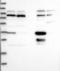 Prostaglandin Reductase 1 antibody, NBP1-87892, Novus Biologicals, Western Blot image 