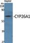 Cytochrome P450 Family 26 Subfamily A Member 1 antibody, PA5-50944, Invitrogen Antibodies, Western Blot image 