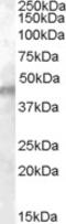 Potassium Voltage-Gated Channel Subfamily J Member 11 antibody, EB07766, Everest Biotech, Western Blot image 