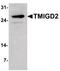 Transmembrane And Immunoglobulin Domain Containing 2 antibody, PA5-38055, Invitrogen Antibodies, Western Blot image 