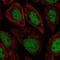 General Transcription Factor IIH Subunit 3 antibody, NBP2-30371, Novus Biologicals, Immunocytochemistry image 