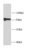 Insulin Like Growth Factor 2 MRNA Binding Protein 3 antibody, FNab04173, FineTest, Western Blot image 