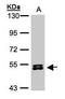 Ribosomal Protein S6 Kinase B2 antibody, GTX101887, GeneTex, Western Blot image 