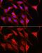Rac Family Small GTPase 1 antibody, GTX55772, GeneTex, Immunocytochemistry image 