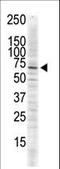 Calcium/Calmodulin Dependent Protein Kinase II Delta antibody, LS-C100735, Lifespan Biosciences, Western Blot image 