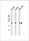 Ras Homolog Family Member C antibody, 57-478, ProSci, Western Blot image 