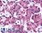 Solute Carrier Family 7 Member 11 antibody, LS-A3053, Lifespan Biosciences, Immunohistochemistry frozen image 