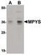 Transmembrane Protein 173 antibody, PA5-20782, Invitrogen Antibodies, Western Blot image 