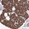 Protein kintoun antibody, HPA002894, Atlas Antibodies, Immunohistochemistry paraffin image 
