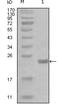 Component Of Inhibitor Of Nuclear Factor Kappa B Kinase Complex antibody, MA5-15427, Invitrogen Antibodies, Western Blot image 