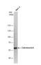 Protein Phosphatase 3 Catalytic Subunit Alpha antibody, NBP2-15663, Novus Biologicals, Western Blot image 