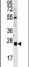 Ubiquitin Conjugating Enzyme E2 E3 antibody, PA5-12065, Invitrogen Antibodies, Western Blot image 