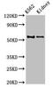 Aldehyde Dehydrogenase 1 Family Member A2 antibody, CSB-PA001566EA01HU, Cusabio, Western Blot image 