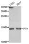 Parathyroid Hormone antibody, abx004483, Abbexa, Western Blot image 