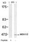 Mitogen-Activated Protein Kinase Kinase 1 antibody, 79-360, ProSci, Western Blot image 