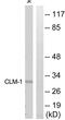 CD300 Molecule Like Family Member F antibody, abx015191, Abbexa, Western Blot image 