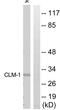 Immune receptor expressed on myeloid cells 1 antibody, abx015191, Abbexa, Western Blot image 