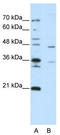 Zinc Finger Protein 488 antibody, TA345572, Origene, Western Blot image 