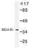 Melanocortin 4 Receptor antibody, AP01319PU-N, Origene, Western Blot image 