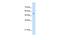 Serine Hydroxymethyltransferase 2 antibody, GTX46481, GeneTex, Western Blot image 