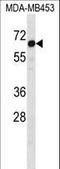 STEAP3 Metalloreductase antibody, LS-C161557, Lifespan Biosciences, Western Blot image 