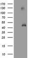 MAGE Family Member A3 antibody, TA800832BM, Origene, Western Blot image 