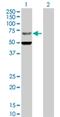 Zinc Finger Protein 182 antibody, H00007569-D01P, Novus Biologicals, Western Blot image 