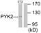 Protein Tyrosine Kinase 2 Beta antibody, LS-C117575, Lifespan Biosciences, Western Blot image 