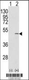 Capping Actin Protein Of Muscle Z-Line Subunit Beta antibody, 61-580, ProSci, Western Blot image 