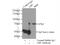 Lipopolysaccharide Binding Protein antibody, 11836-1-AP, Proteintech Group, Immunoprecipitation image 