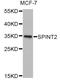 Serine Peptidase Inhibitor, Kunitz Type 2 antibody, A6749, ABclonal Technology, Western Blot image 