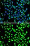 Small glutamine-rich tetratricopeptide repeat-containing protein alpha antibody, GTX55797, GeneTex, Immunofluorescence image 