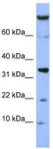 Family With Sequence Similarity 178 Member B antibody, TA345018, Origene, Western Blot image 