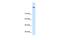 Amine Oxidase Copper Containing 2 antibody, A11436, Boster Biological Technology, Western Blot image 