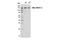 Myocardin Related Transcription Factor A antibody, 14760S, Cell Signaling Technology, Western Blot image 